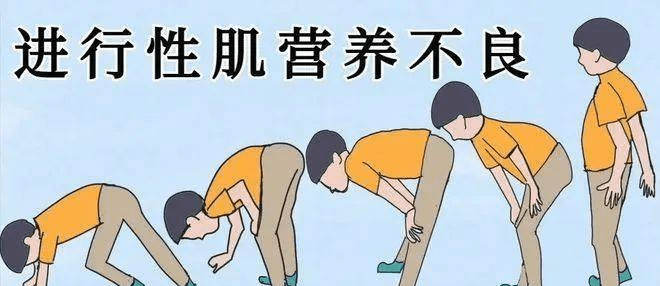 肌营养不良最新进展,肌营养不良最新进展