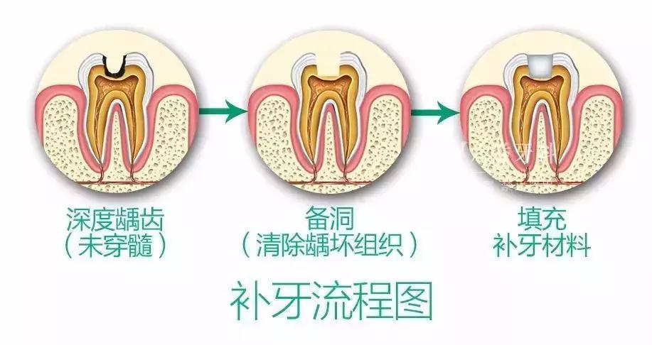 最新补牙材料观点论述，探索前沿技术与材料的发展